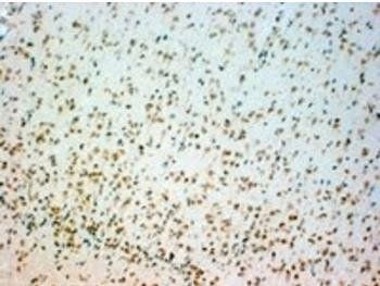 Tryptophan hydroxylase 2/TPH2 Antibody