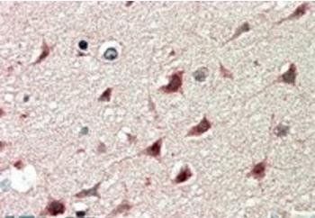 Goat anti-DCDC2 Antibody