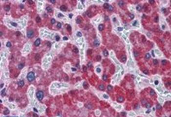Goat anti-Stearoyl-CoA desaturase Antibody