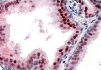 Goat anti-P27KIP1 / CDKN1B (internal) Antibody