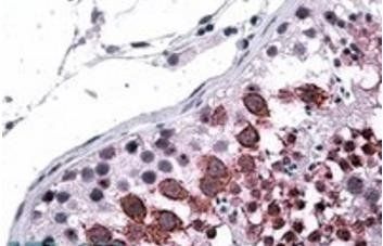 Goat anti-Galanin Receptor 3 Antibody