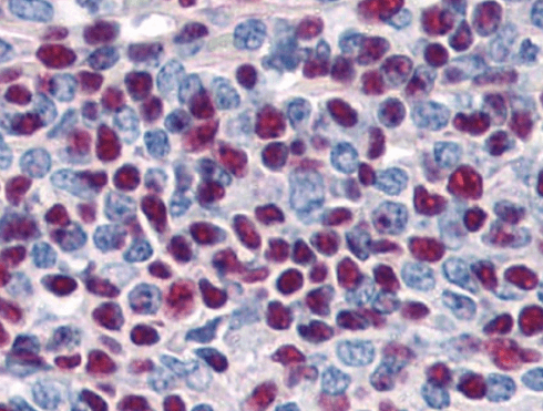Goat anti-Ku80 / XRCC5 Antibody