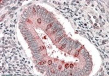 Goat anti-Hamartin / TSC1 (isoform 1) Antibody