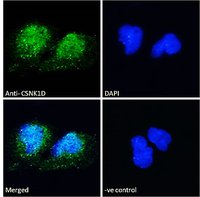 CSNK1D antibody