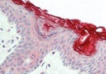 Goat anti-PERP Antibody