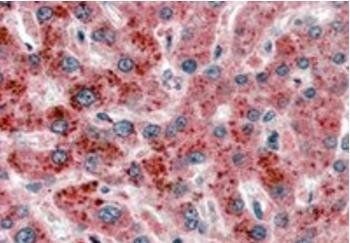 Goat anti-AKR1C4 Antibody