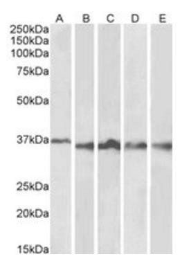 Aurora Kinase B Antibody