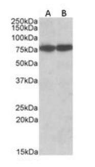 HSPA8 (Isoform 1) Antibody