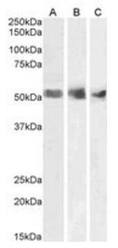 Goat anti-Wilms tumor 1 / WT1 Antibody