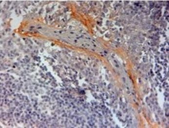 CIAS1/Cryopyrin (Internal) Antibody