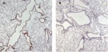 Goat anti-Munc13-4 / UNC13D (Internal) Antibody