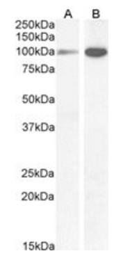 Goat anti-NMDA receptor 1 / GRIN1 Antibody