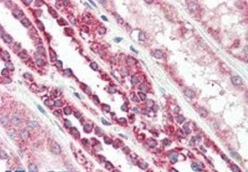 Goat anti-TSPO / PBR (isoform) Antibody