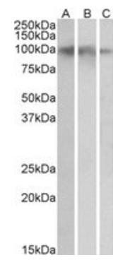 NTRK2 Antibody