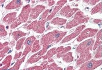 Goat anti-CPT1A Antibody
