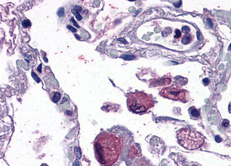 Goat anti-FLAP / ALOX5AP (internal) Antibody