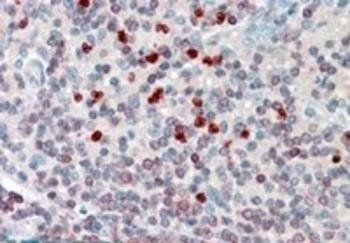 Goat anti-FLAP / ALOX5AP (internal) Antibody