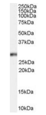 Goat anti-Homeobox B13 Antibody