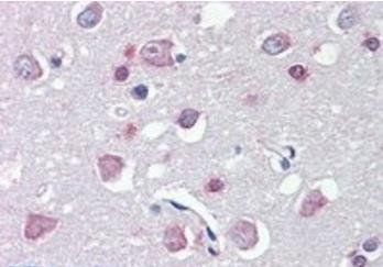Goat anti-FEZ1 / Zygin 1 Antibody