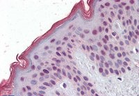 Goat anti-MBD2 (isoform 1) Antibody