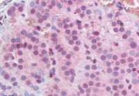 Goat anti-MBD2 (isoform 1) Antibody