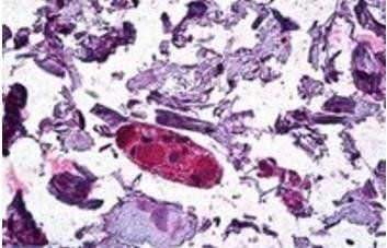 Goat anti-DGAT1 Antibody
