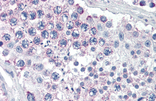 Goat anti-GPSM2 Antibody