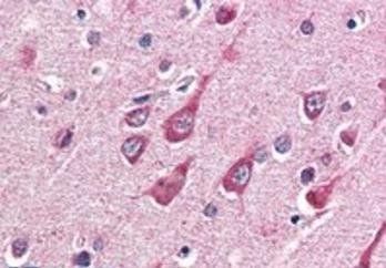 Goat anti-OGT Antibody