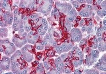 Goat anti-CGI58 / ABHD5 Antibody