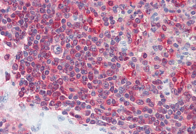 Goat anti-PSME2 Antibody
