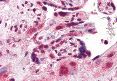 AIP/ARA9 Antibody