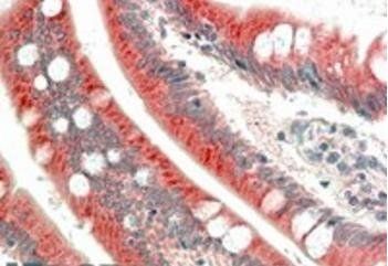 MIC1/C18orf8 Antibody
