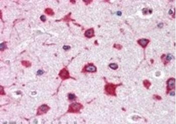 Goat anti-ribosomal protein L8 Antibody