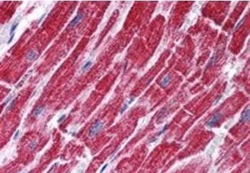 Goat anti-Fumarase / FH Antibody