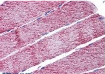 Goat anti-Fumarase / FH Antibody