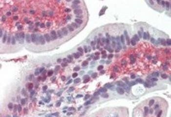 Goat anti-EGR2 Antibody