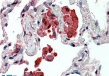 Goat anti-Insulysin / Insulinase Antibody