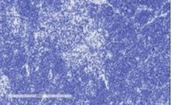 Goat anti-Tcfec (mouse) Antibody