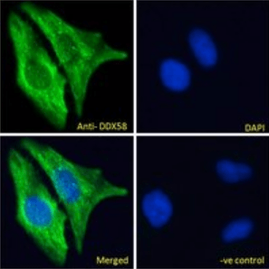 Goat anti-DDX58 Antibody