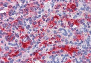 Goat anti-DDX58 Antibody