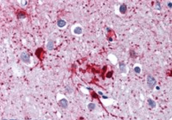 Goat anti-DDX58 Antibody