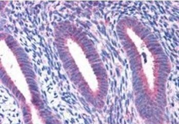 Goat anti-Ribosomal protein L22 Antibody