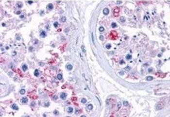 Goat anti-Ribosomal protein L22 Antibody