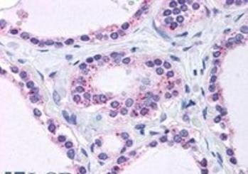 Goat anti-Ribosomal protein L22 Antibody