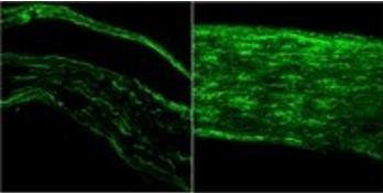 Goat anti-BDNF Antibody