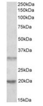 Goat anti-ASRGL1 / ALP Antibody