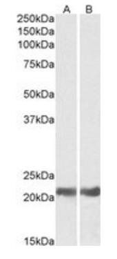 Goat anti-CRYAB Antibody