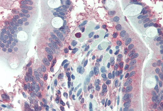 Goat anti-LASP1 (internal region) Antibody