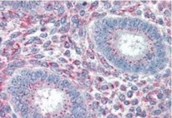 PRRX1 Antibody