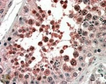 Goat anti-ACVR1 Antibody